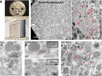 Review of Post-embedding Immunogold Methods for the Study of Neuronal Structures